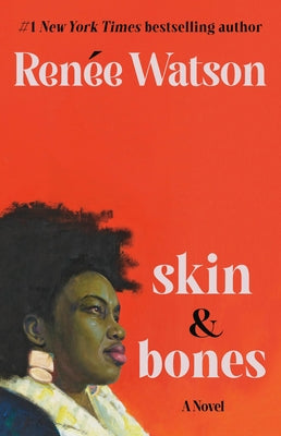 Skin & Bones by Watson, Ren馥